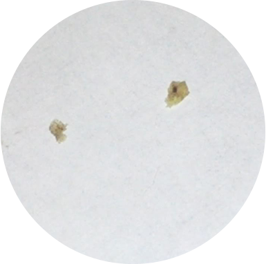 Yellow flakes around beds